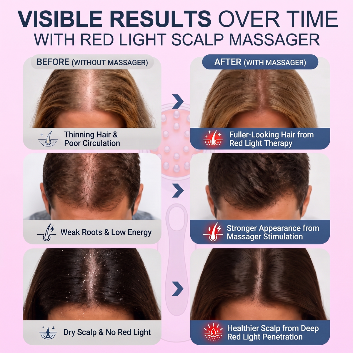 Vestra Red Light Scalp Massager